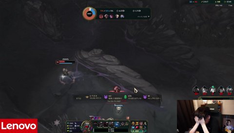 本当に生え際が心配