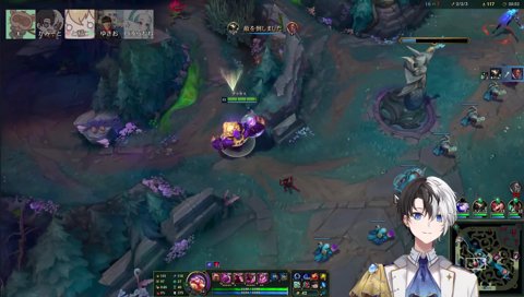 歯茎アズールを処すかみーと