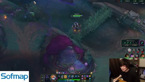 掻き上げた髪があまりにも禿すぎている