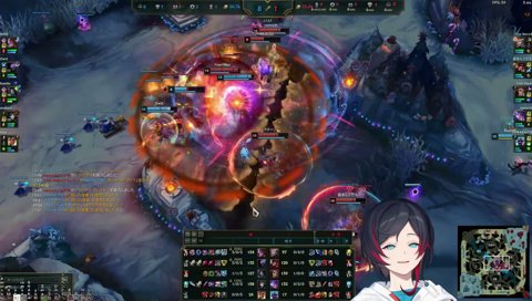 らいさまに指摘される大歯茎