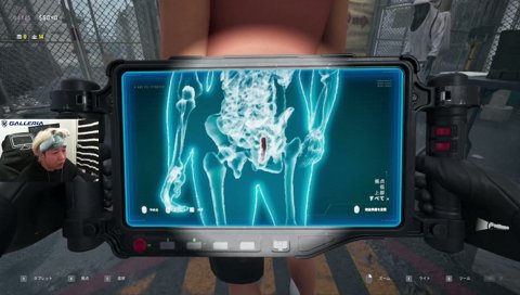 ケツからウインナー