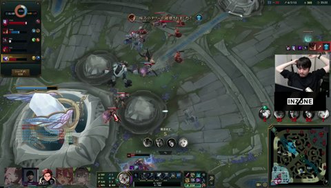 咄嗟のシーカーアームガード購入